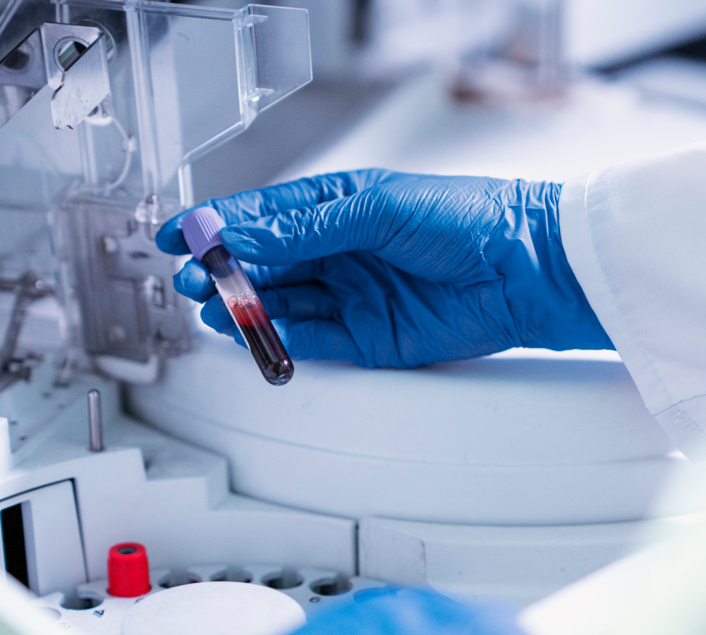 Diagnostyka laboratoryjna - próbka krwi w analizatorze ALAB laboratoria